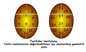 Testiküler Haritalama