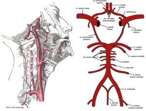 Arteriyel Doppler Ultrason